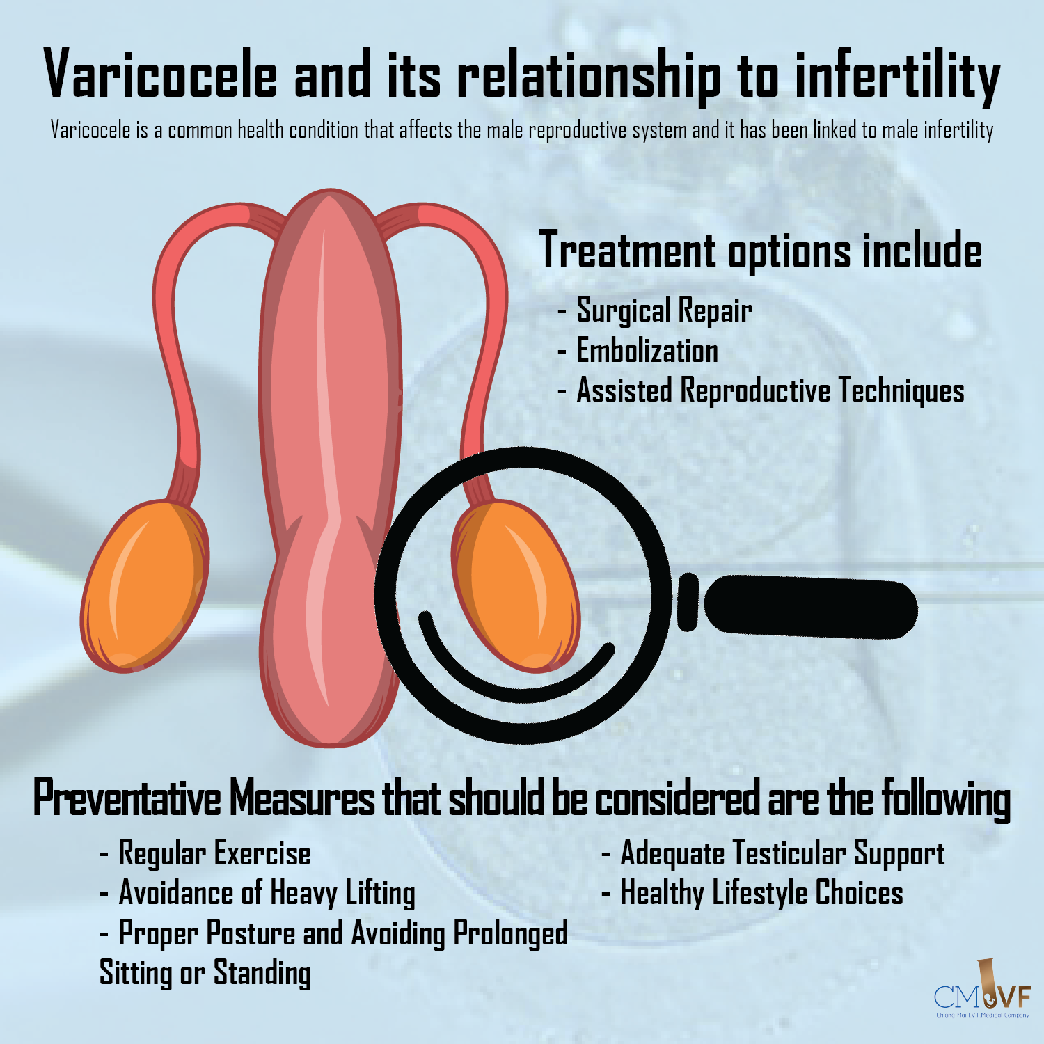 Varicocele and its relationship to infertility