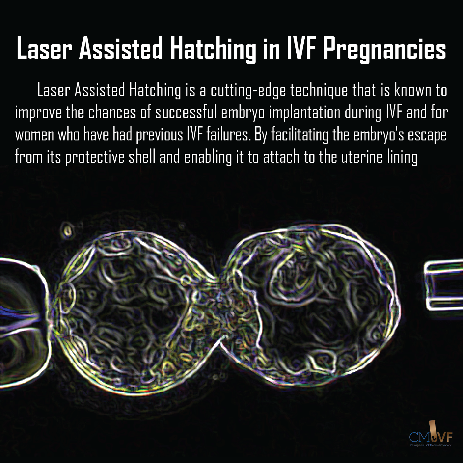 Laser Assisted Hatching in IVF Pregnancies